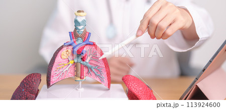 Doctor with Smoker and normal Lung anatomy for Disease. Lung Cancer, Asthma, Chronic Obstructive Pulmonary or COPD, Bronchitis, Emphysema, Cystic Fibrosis, Bronchiectasis, Pneumonia and world Lung day 113924600