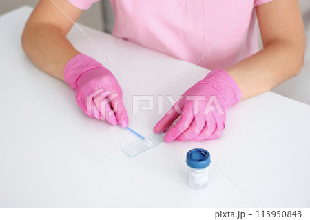 A cervical brush for taking a smear on the microflora in women. Gynecological examination A cervical brush for taking a smear on the microflora in women. Gynecological examination 113950843