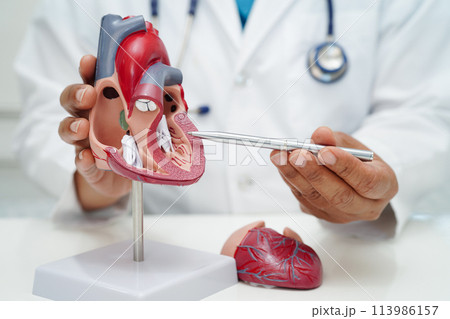 Cardiovascular disease CVD, doctor with heart human model anatomy for treatment patient in hospital. 113986157