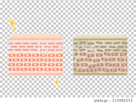 皮膚圖對比圖 113992553