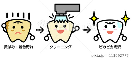 汚れた歯をブラシで掃除して綺麗にホワイトニングされた歯のイラスト 汚れた歯をブラシで掃除して綺麗にホワイトニングされた歯のイラスト 113992775