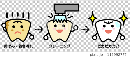 汚れた歯をブラシで掃除して綺麗にホワイトニングされた歯のイラスト 汚れた歯をブラシで掃除して綺麗にホワイトニングされた歯のイラスト 113992775