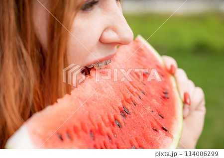 Close-up portrait of red-haired young woman with braces eating watermelon outdoors Close-up portrait of red-haired young woman with braces eating watermelon outdoors 114006299