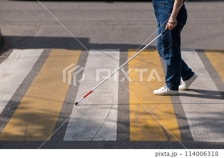 Close-up of the legs of a blind woman crossing the road at a crosswalk with a cane.  114006318