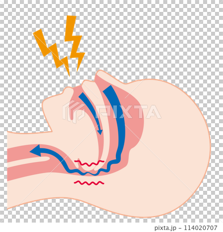 The mechanism of snoring 114020707