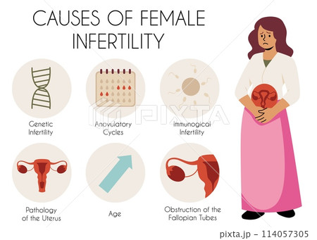 Information vector poster about the causes of female infertility. 114057305