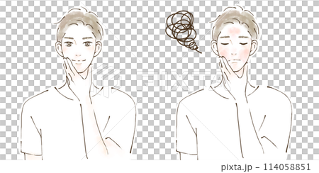 肌荒れ改善　before after男性のイラストセット　アレルギー　アトピー 114058851