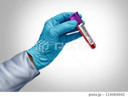 Monkeypox diagnosis 114069042