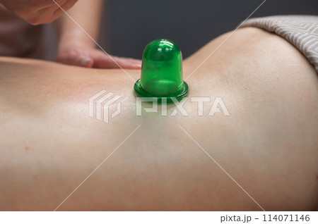 A woman undergoes an anti-cellulite massage procedure using a vacuum jar. Close-up of the lower back.  114071146