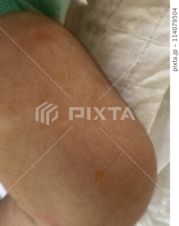 Close up of a newborn baby's leg in a hospital bed. Close up of a newborn baby's leg in a hospital bed. 114079504