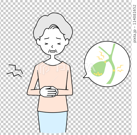 Illustration of a senior woman suffering from gallstones 114081652