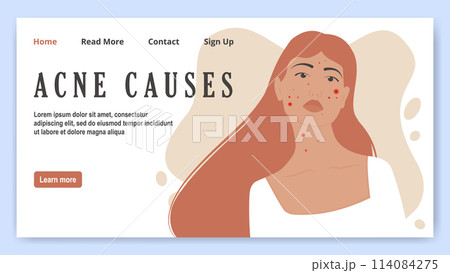 Girl with acne, problem skin banner. Cartoon scene skin problem isolated on white background. Girl with acne, problem skin banner. Cartoon scene skin problem isolated on white background. 114084275