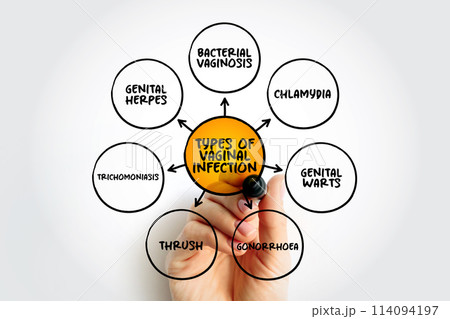 Types of vaginal infection mind map, text concept for presentations and reports 114094197