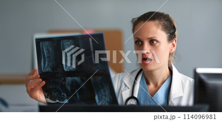 Excited woman doctor hold x-ray film in hand againt 114096981