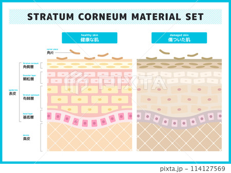 健康な肌と傷ついた肌のイラスト素材セット 114127569