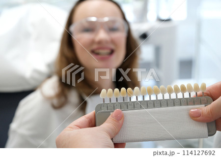 video tooth whitening, perfect white crown teeth close up with shade guide bleach color, female veneer smile, dental care and stomatology, dentistry, copyspace. 114127692