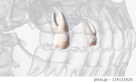 The maxillary second molars resemble the maxillary first molars anatomically The maxillary second molars resemble the maxillary first molars anatomically 114131628