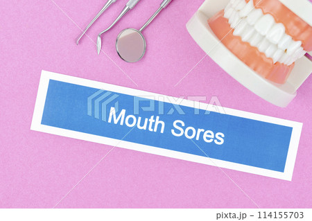 Mouth Sores dental disease and teeth model 114155703