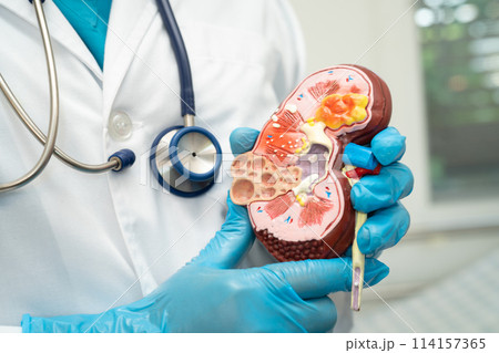 Kidney disease, Chronic kidney disease ckd, Doctor with human model to study and treat in hospital. Kidney disease, Chronic kidney disease ckd, Doctor with human model to study and treat in hospital. 114157365