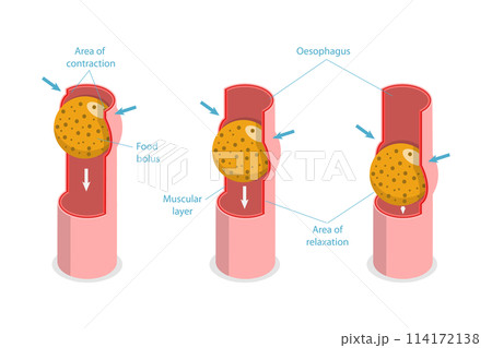 3D Isometric Flat  Conceptual Illustration of Peristalsis, Swallow Eating Problem 114172138