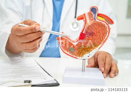 Stomach disease, doctor with anatomy model for study diagnosis and treatment in hospital. 114183115