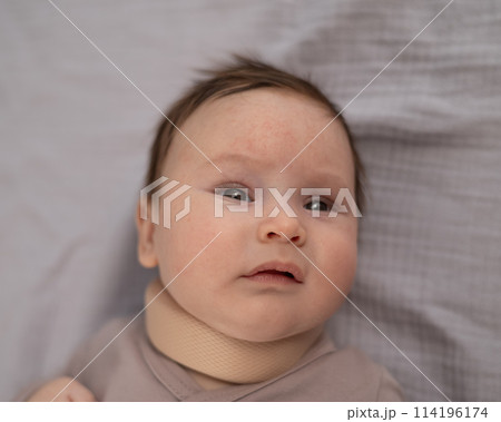 Top view of a newborn baby wearing an orthopedic collar. Top view of a newborn baby wearing an orthopedic collar. 114196174