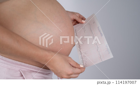 Pregnant woman with bare belly holding Cardiotocography results. Pregnant woman with bare belly holding Cardiotocography results. 114197007