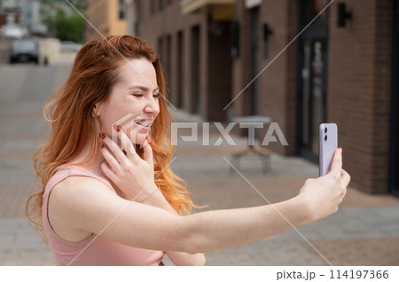 Young woman with braces on her teeth smiles and takes a selfie on a smartphone outdoors. Young woman with braces on her teeth smiles and takes a selfie on a smartphone outdoors. 114197366