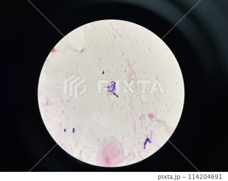 Yeast cell in gram stain. 114204691