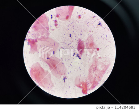Yeast cell in gram stain. 114204693