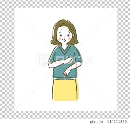 一名因藥物副作用而出現濕疹的女性 114211850