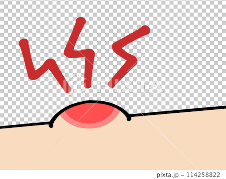 蚊に刺されのイラスト素材 114258822