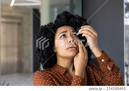 A woman with curly hair in a brown polka dot blouse carefully applies eye drops, expressing slight discomfort or concern in a modern office setting. A woman with curly hair in a brown polka dot blouse carefully applies eye drops, expressing slight discomfort or concern in a modern office setting. 114280405