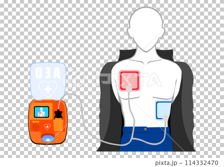 Install an AED (Automated External Defibrillator) 114332470