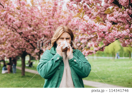 Sneezing young redhead woman with nose wiper among blooming trees in park. Portrait of sick women sneezes in white tissue, suffers from rhinitis and running nose. Symptoms of cold or allergy. 114341746