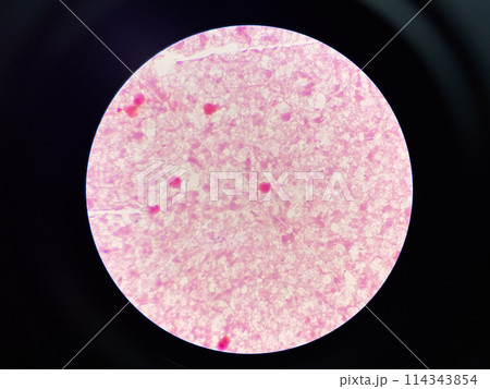 red bacteria cell branching in hemoculture. 114343854