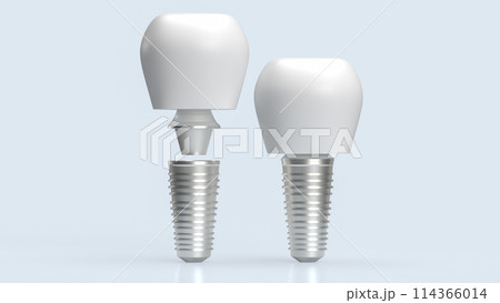 The dental implants for health and medical concept 3d rendering. 114366014