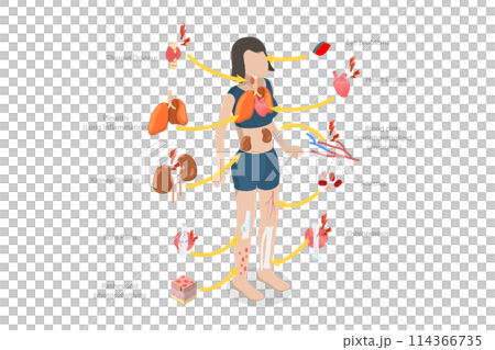 3D Isometric Flat Conceptual Illustration of Lupus Erythematosus, SLE Symptoms and Signs 3D Isometric Flat Conceptual Illustration of Lupus Erythematosus, SLE Symptoms and Signs 114366735