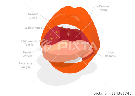 3D Isometric Flat Conceptual Illustration of Parts Of Human Mouth, Educational Diagram 3D Isometric Flat Conceptual Illustration of Parts Of Human Mouth, Educational Diagram 114366740