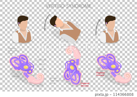 3D Isometric Flat Conceptual Illustration of Vertigo Syndrome , BPPV 3D Isometric Flat Conceptual Illustration of Vertigo Syndrome , BPPV 114366808