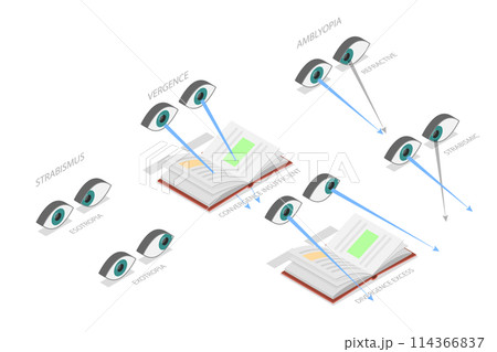 3D Isometric Flat Conceptual Illustration of Binocular Vision Disorders, Medical Sight Health Problems 3D Isometric Flat Conceptual Illustration of Binocular Vision Disorders, Medical Sight Health Problems 114366837