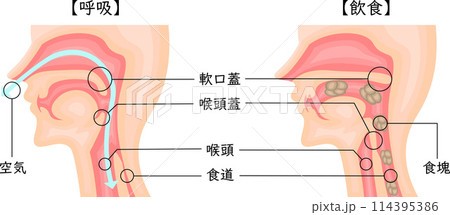 飲食 呼吸 嚥下性無呼吸 イラスト 日本語 飲食 呼吸 嚥下性無呼吸 イラスト 日本語 114395386