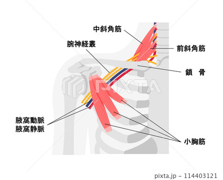 胸郭出口症候群の発生する部位の図解 イラスト 胸郭出口症候群の発生する部位の図解 イラスト 114403121