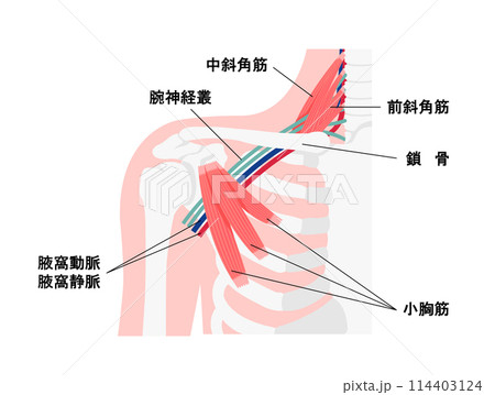 胸郭出口症候群の発生する部位の図解 イラスト 114403124