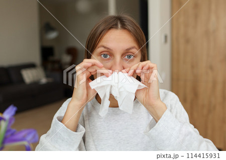 Allergy, flu, cold, rhinitis. Funny face of sick woman with paper tissues inside nose from runny nose and sneezes at home. Hay fever, sinusitis and female with viral infection blowing in handkerchief Allergy, flu, cold, rhinitis. Funny face of sick woman with paper tissues inside nose from runny nose and sneezes at home. Hay fever, sinusitis and female with viral infection blowing in handkerchief 114415931