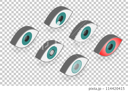 3D Isometric Flat Set of Eyes with Different Problems, Human Eye and Vision Health 3D Isometric Flat Set of Eyes with Different Problems, Human Eye and Vision Health 114420415