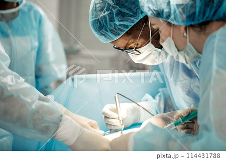diverse doctors focusing on abdominal contents, the colon, liver diverse doctors focusing on abdominal contents, the colon, liver 114431788