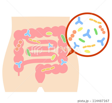 大腸に住む腸内細菌と腹部のイラスト 114487167