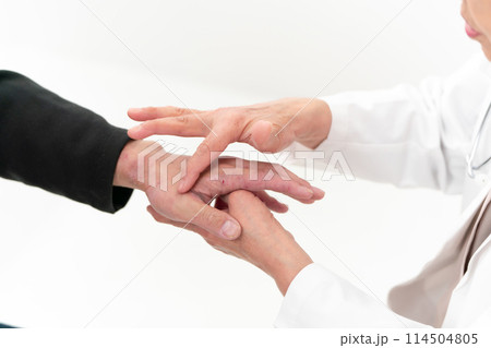医療 アトピー性皮膚炎 手元 医療 アトピー性皮膚炎 手元 114504805