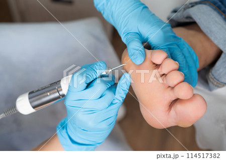 Professional removing a callus on a womans foot by electric drill Professional removing a callus on a womans foot by electric drill 114517382